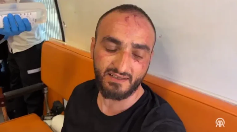 Photojournalist Mustafa al-Haruf after being beaten by Border Police officers, screenshot from Turkish television broadcasts